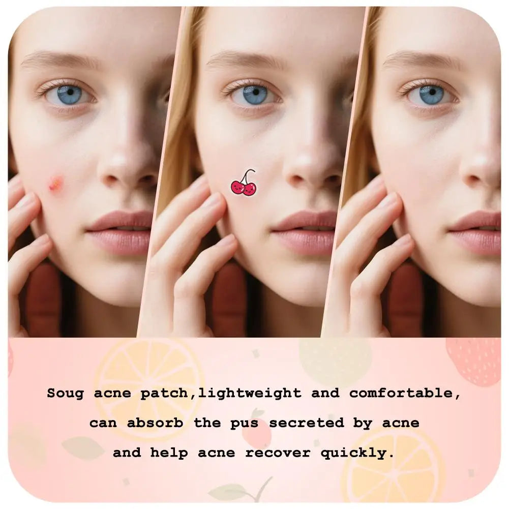 Cute Food Acne Patch – 120 st roliga acneplåster med fruktmotiv, behandlar & täcker finnar